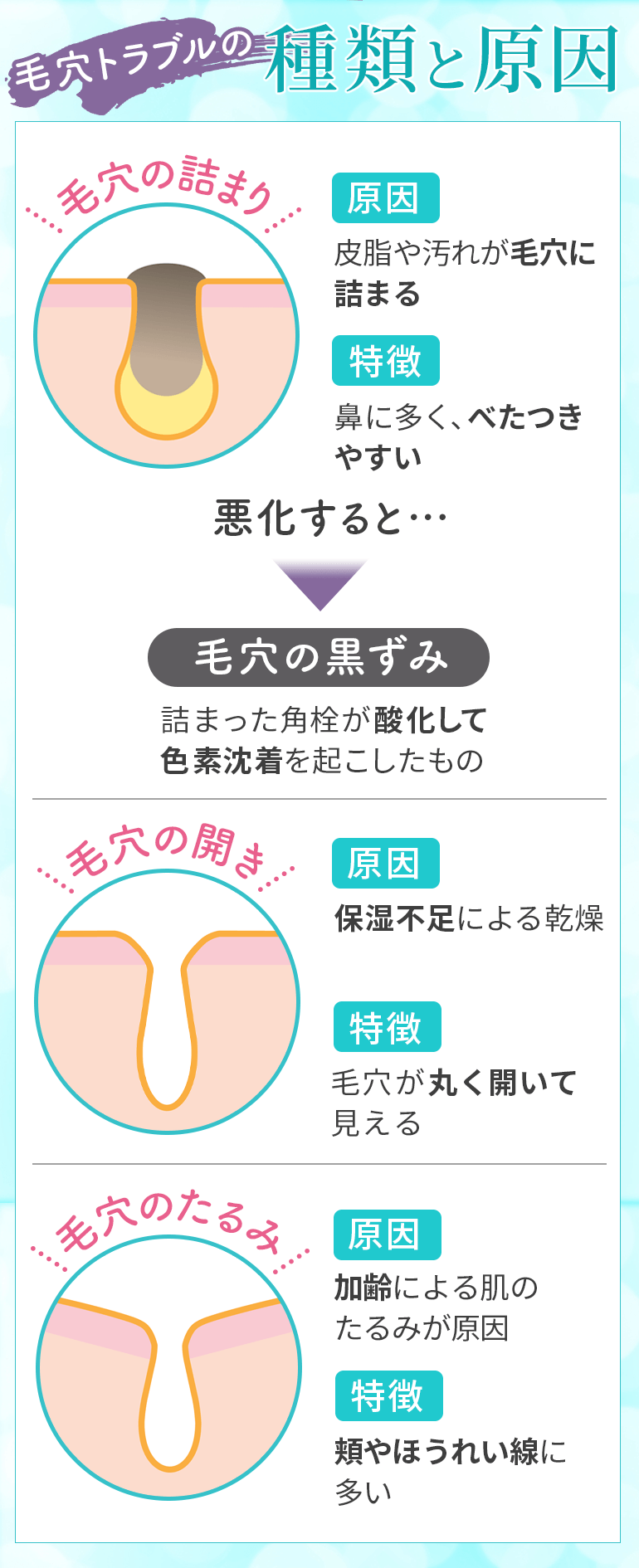 毛穴トラブルの種類と原因