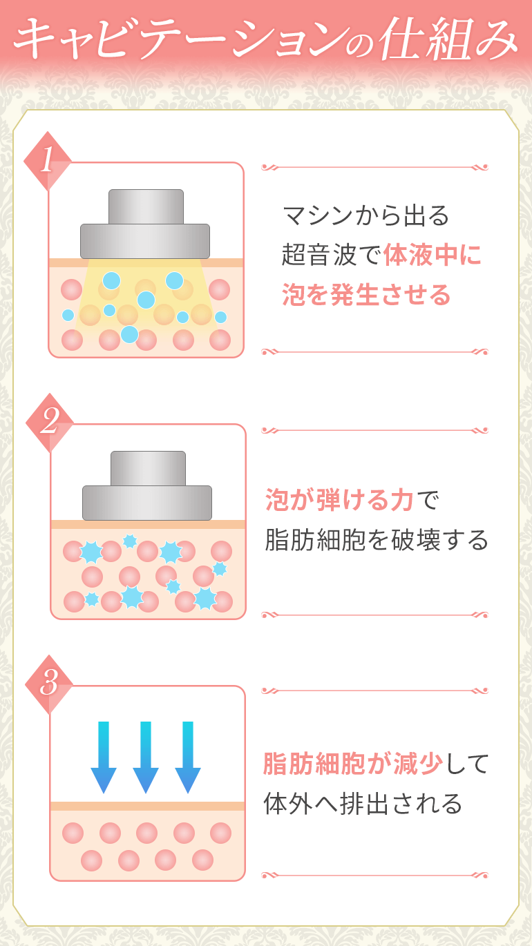 キャビテーションの仕組み